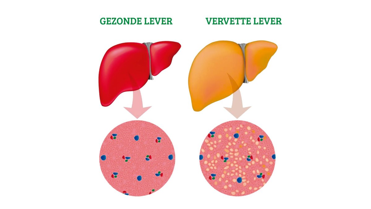 leververvetting aanpakken